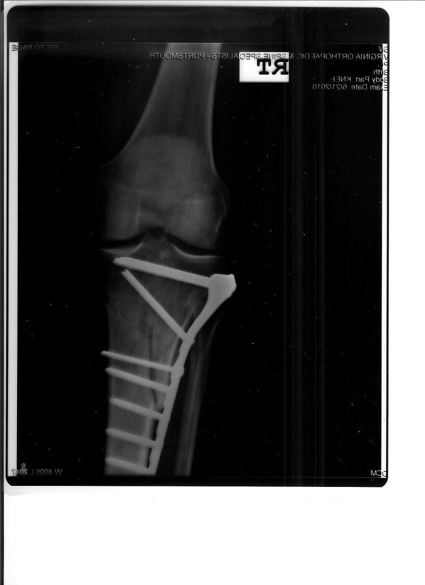 Scanning xrays into the computer. The Café Square Wheels Cycling